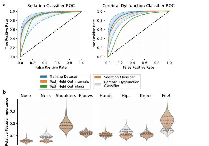 ROC curves for sedation and cerebral dysfunction classifiers with feature-importance distributions by infant body region