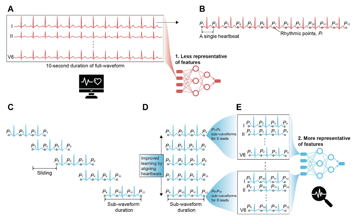 ECG waveforms segmented at rhythmic points and aligned into multilead sub-waveform representations